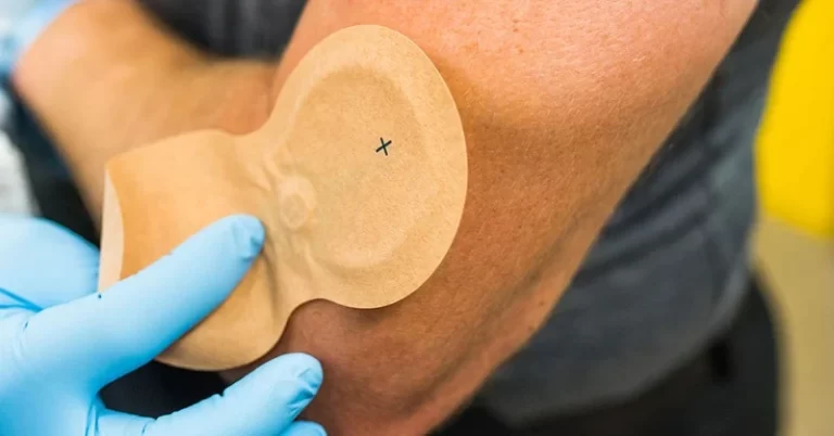 patchaid vitamin patches
